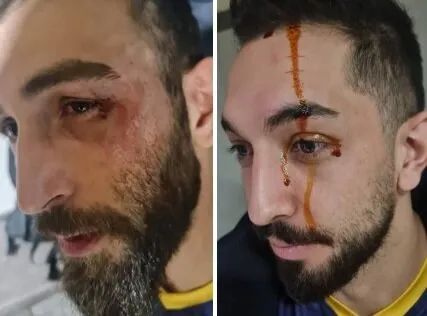 هفته هفدهم لیگ برتر والیبال / کتک کاری در گرگان!