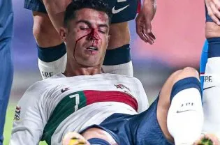 رونالدو مصدوم شد