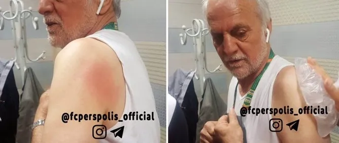 سرپرست تیم پرسپولیس مجروح شد+عکس