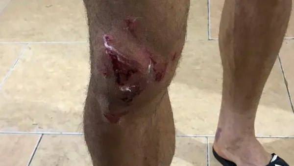 ترابی بازی برابر السد قطر را از دست داد