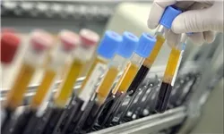 تست دوپینگ 2 وزنه‌بردار المپیکی مثبت اعلام شد